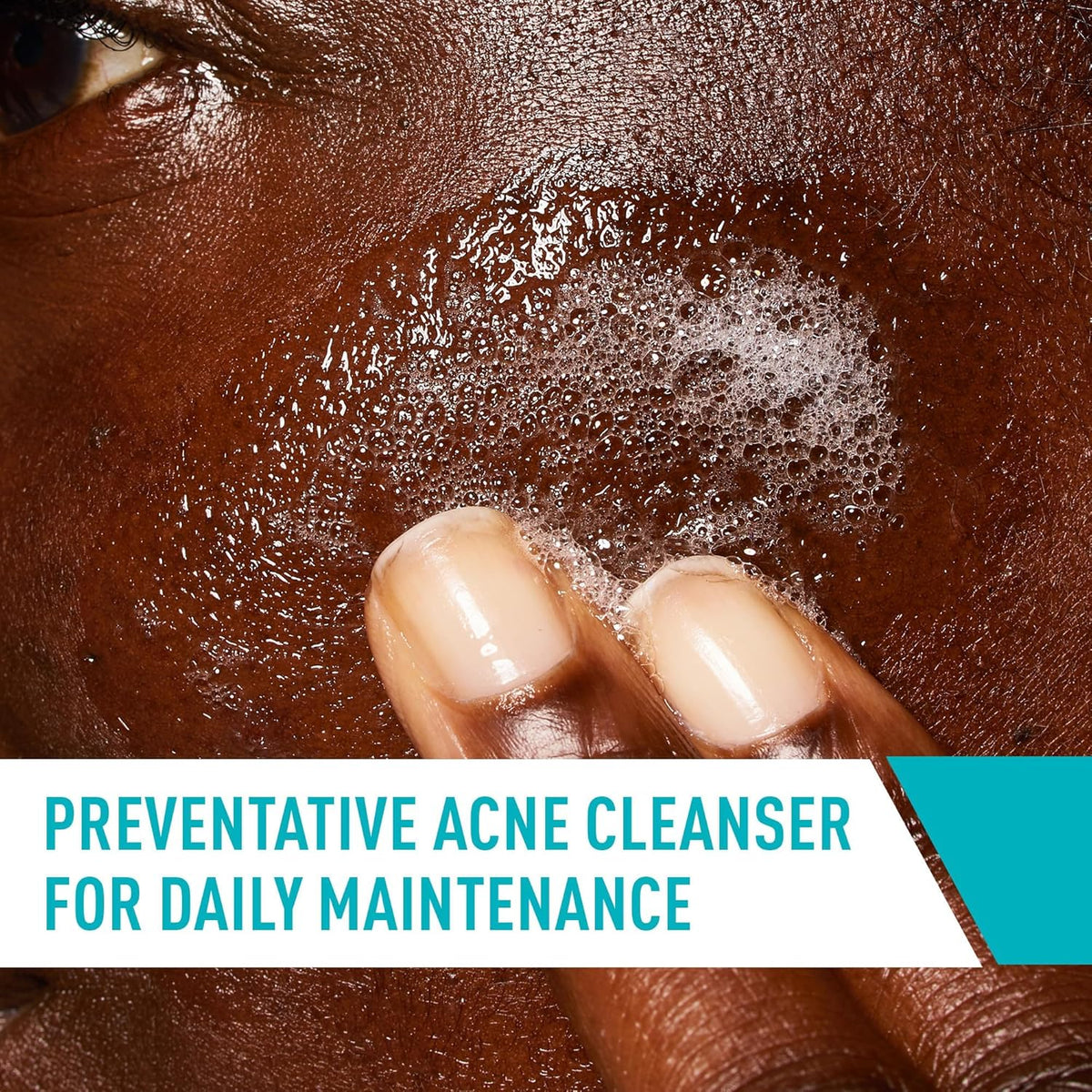 CeraVe Acne Control Cleanser 12oz