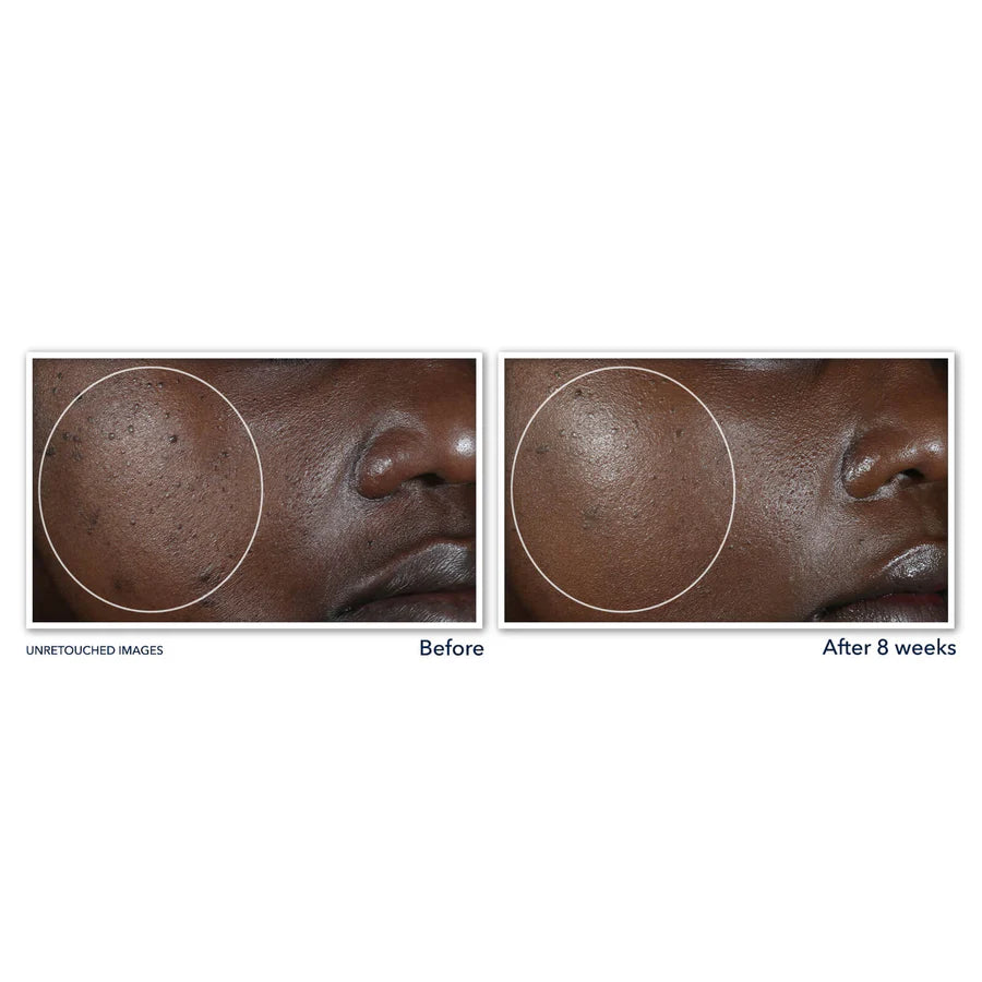 ROC MULTI CORREXION Even Tone + Lift Night Cream