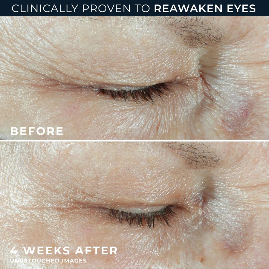 ROC MULTI CORREXION Hydrate + Plump Eye Cream