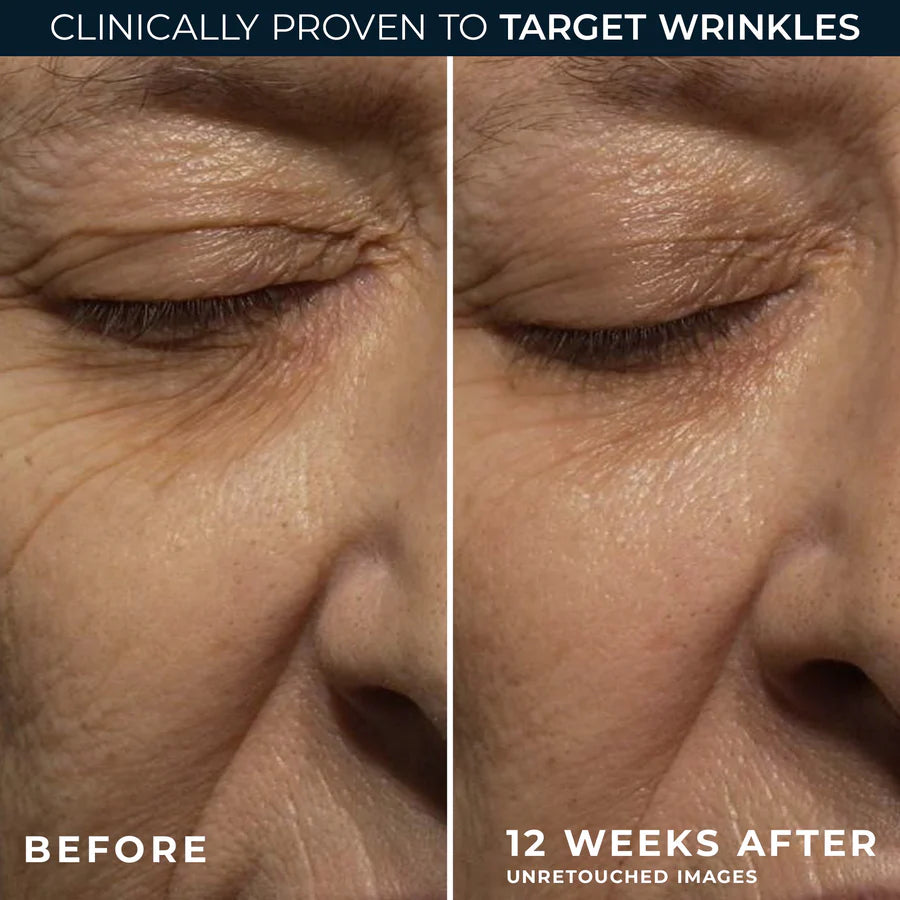ROC RETINOL CORREXION Deep Wrinkle Night Cream