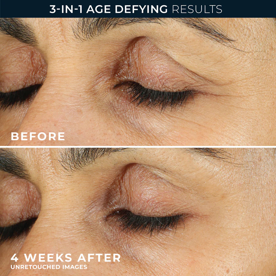 ROC RETINOL CORREXION Line Smoothing Eye Cream