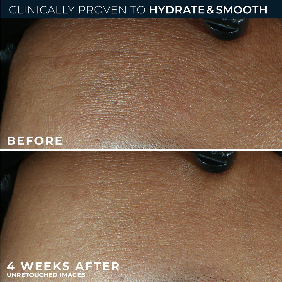 ROC RETINOL CORREXION Line Smoothing Max Hydration Cream
