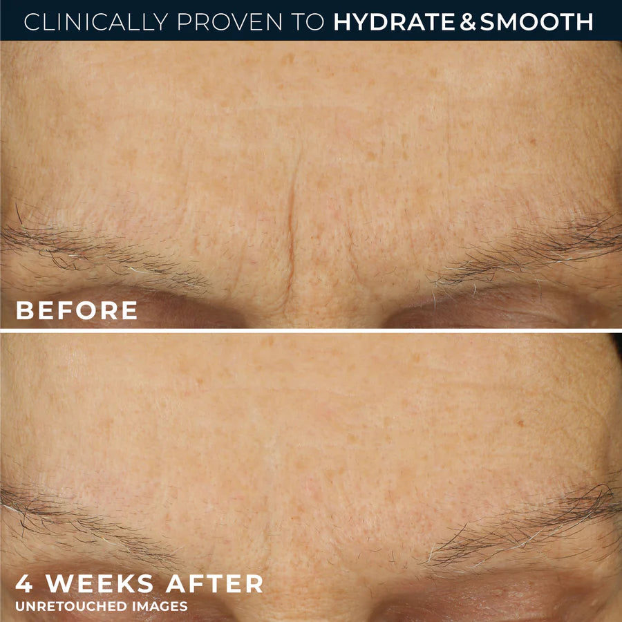 ROC RETINOL CORREXION Line Smoothing Max Hydration Cream