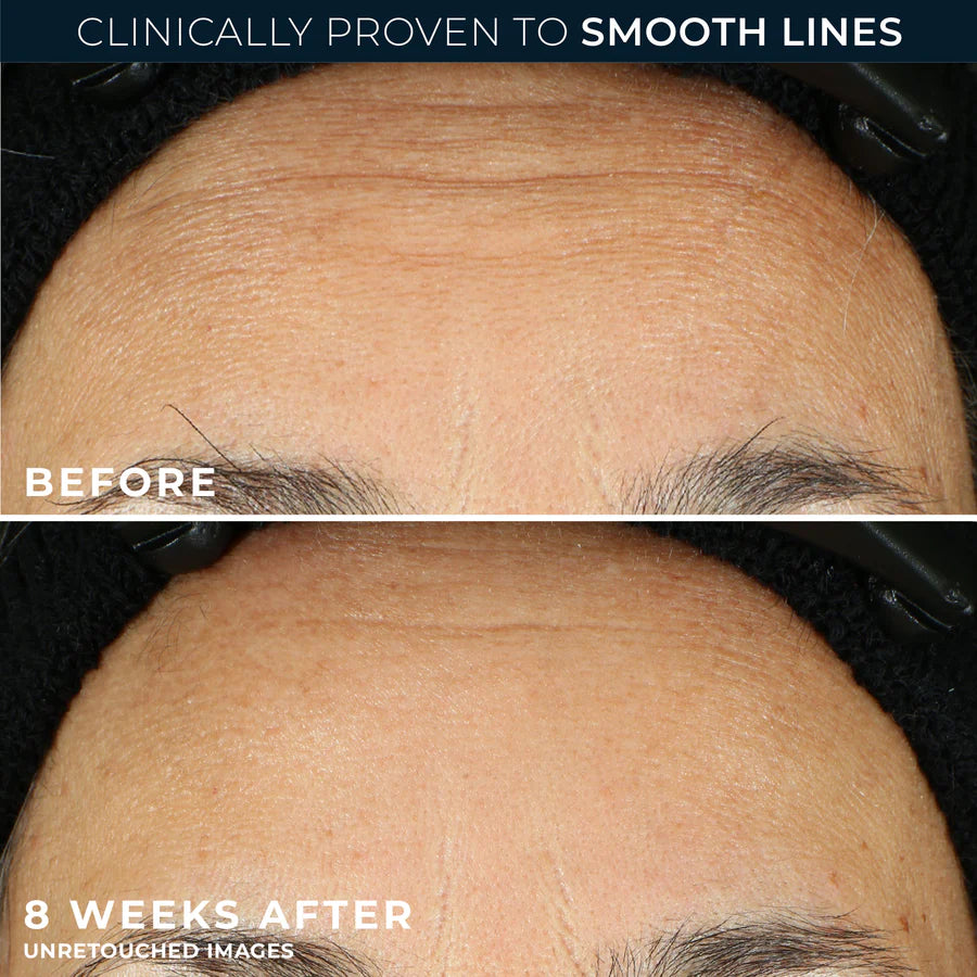 ROC RETINOL CORREXION Line Smoothing Night Serum Capsules