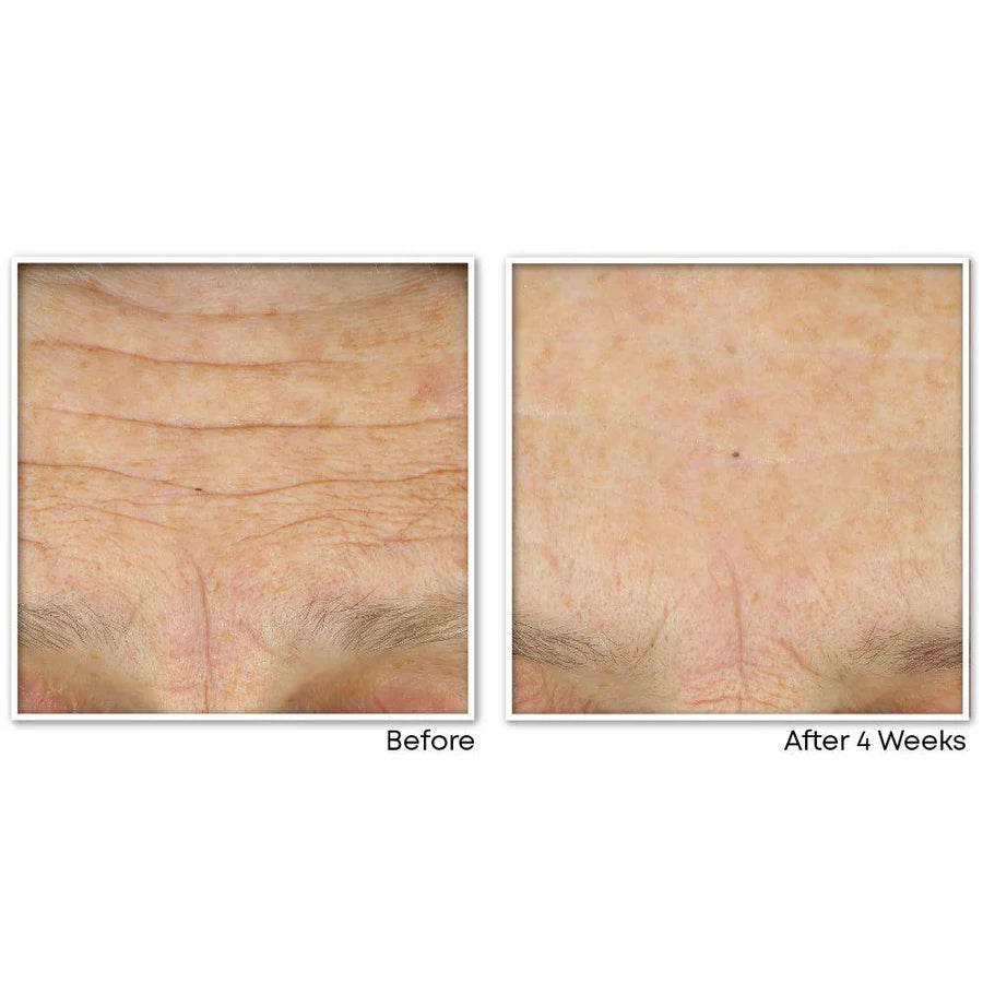 ROC MULTI CORREXION Crépe Repair Face & Neck Cream