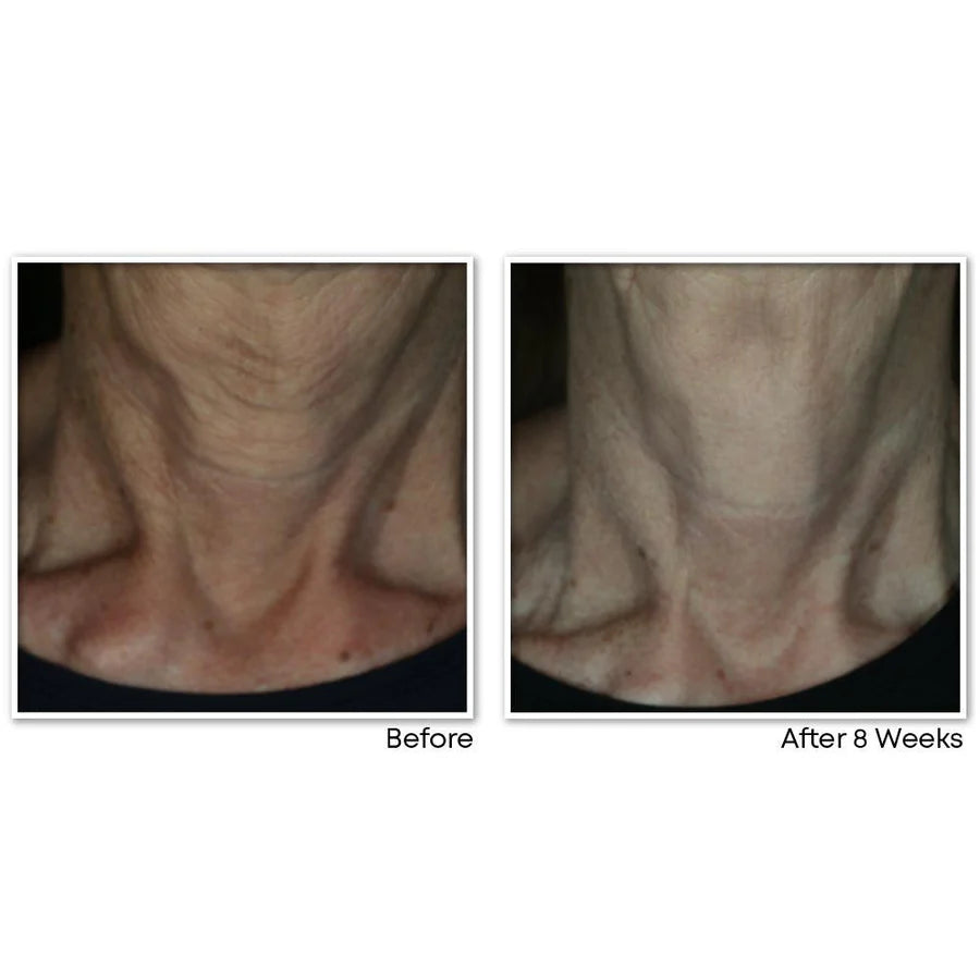 ROC MULTI CORREXION Crépe Repair Face & Neck Cream